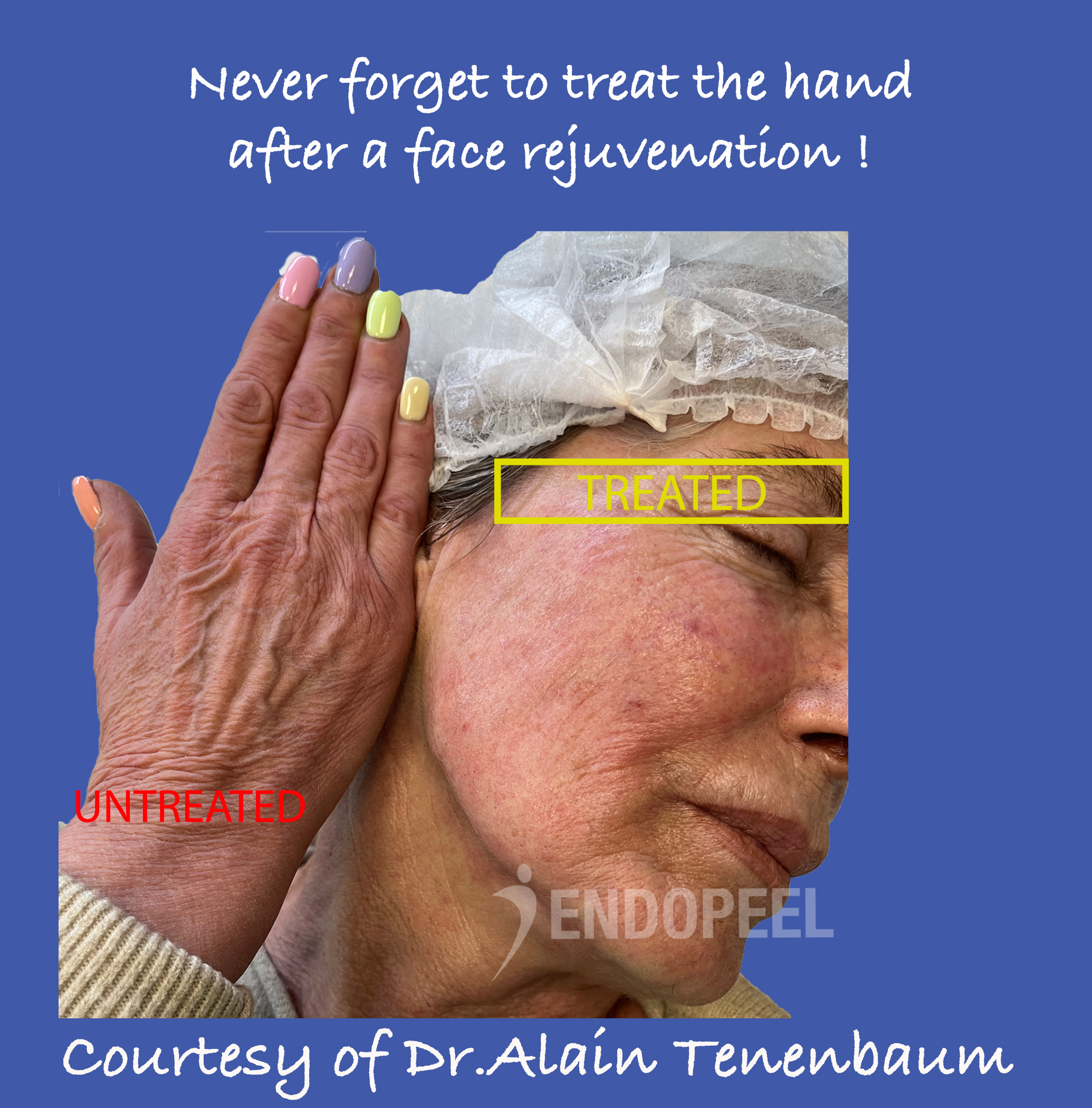 hands-color-vs-face